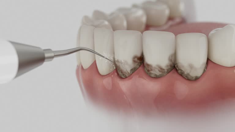 Trusted Dental Implants service in Sharpsville, PA - Dentist Open Now